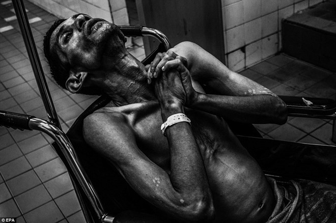 alt text: Bệnh nhân ung thư đang được chăm sóc