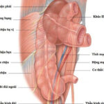Phẫu thuật CME trong điều trị ung thư đại tràng