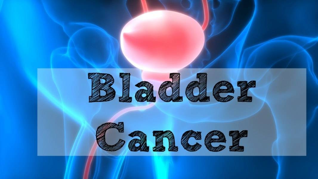 Alt text: Hình ảnh minh họa các loại thuốc hóa trị