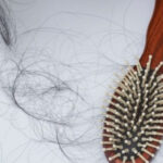 Rụng tóc do điều trị hóa chất – những điều bạn cần biết