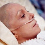 Kế hoạch chăm sóc bệnh nhân ung thư gan giai đoạn cuối