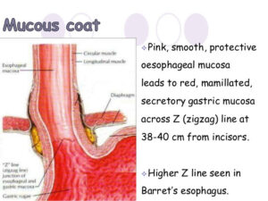 Tổng quan về ung thư ĐOẠN NỐI THỰC QUẢN – DẠ DÀY | Phần 1