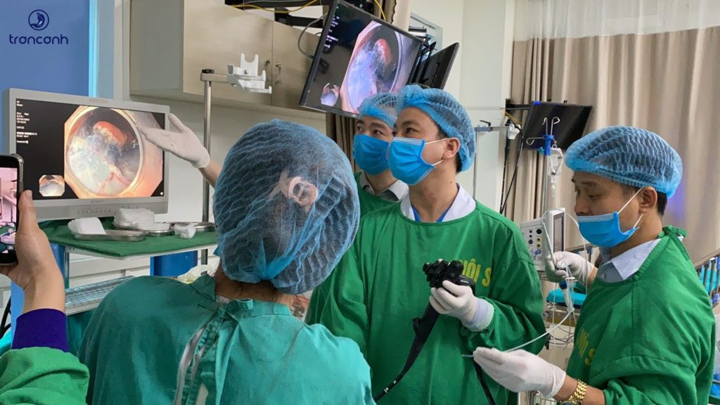 Mô tả kỹ thuật ESD