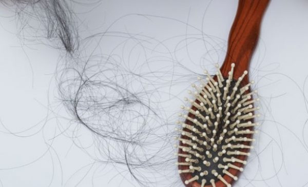 Rụng tóc do hóa chất