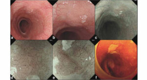 ĐIỀU TRỊ TÂM LINH CHO BỆNH NHÂN UNG THƯ